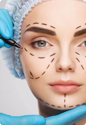 Facelift (Rhytidectomy)