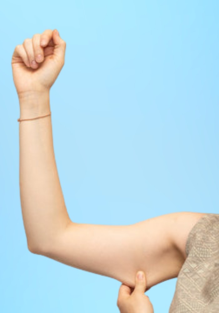 Arm Liposuction