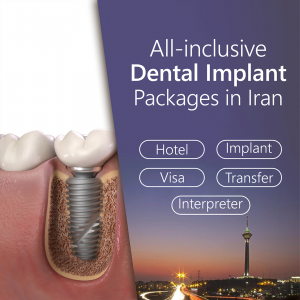 Dentel Implant 300x300 - packages